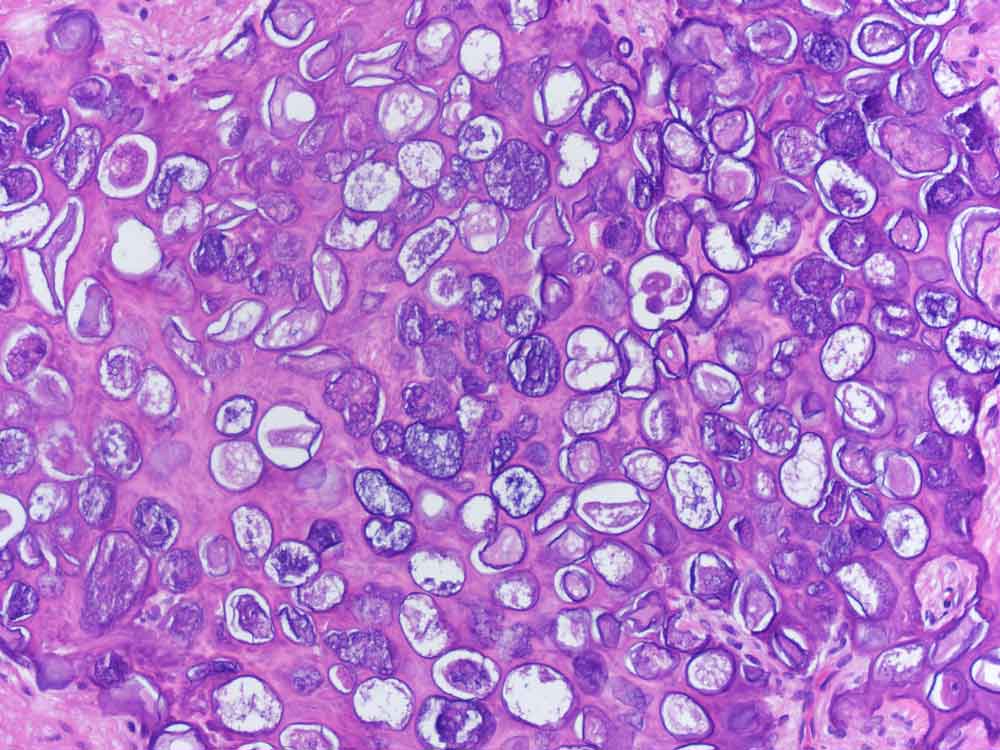 Histologische Untersuchung von Hautproben