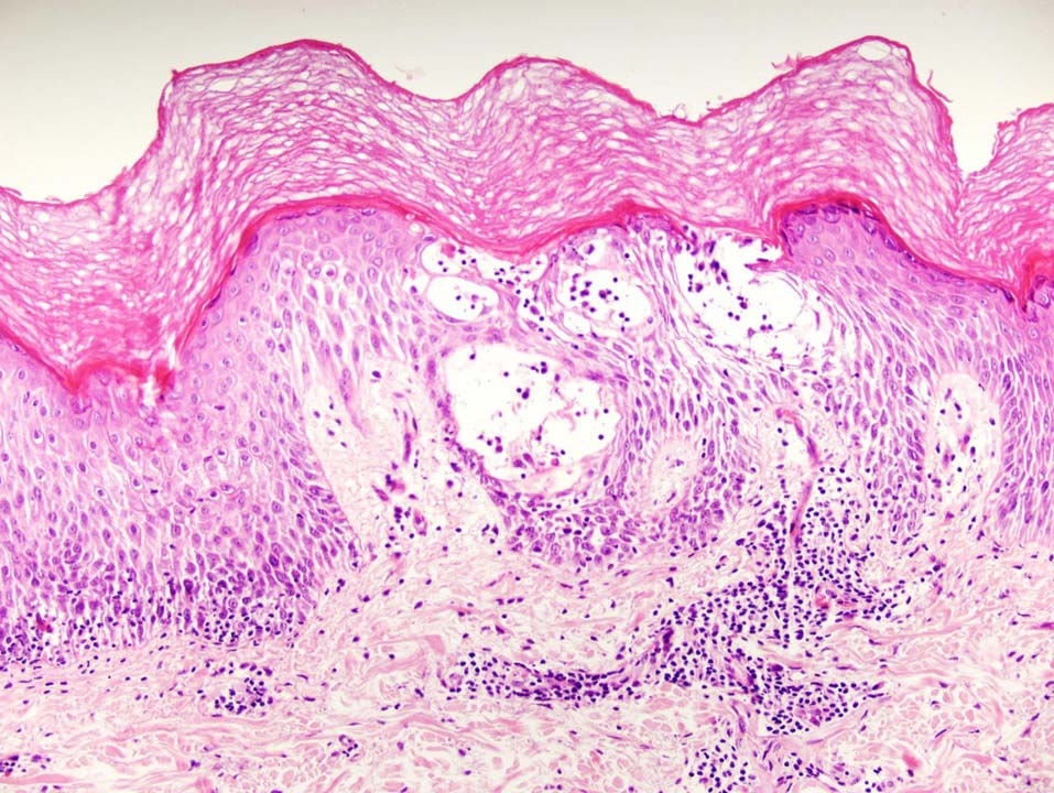 Histologie Pathologie Dermatopathologie Digitale Pathologie